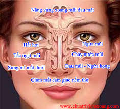 Thuốc nam trị viêm xoang cấp và mạn tính, viêm mũi dị ứng Thuốc nam trị viêm xoang cấp và mạn tính, viêm mũi dị ứng