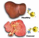 Dấu hiệu nhận biết viêm gan B